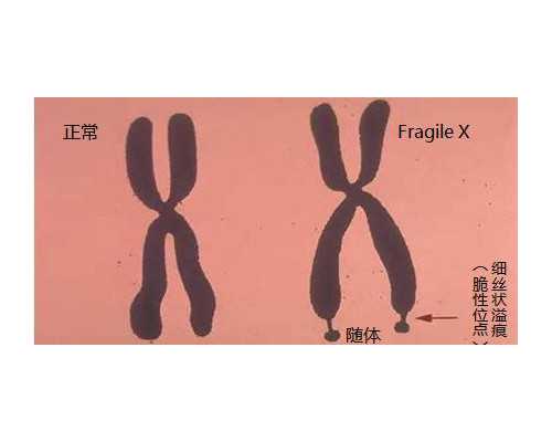 供卵品质_有专业供卵试管,北京试管供卵公司,蒸蒸日上