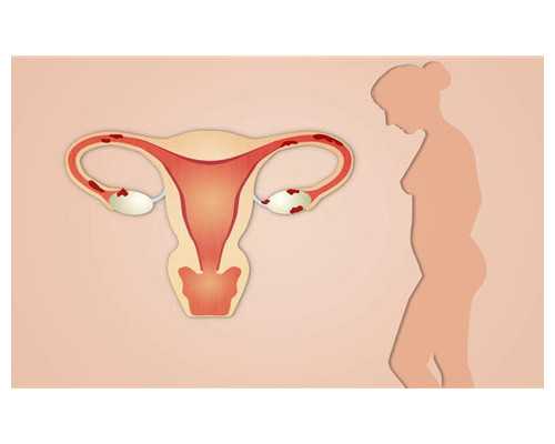 杭州借卵试管婴儿代怀生子医院排名，借卵费用大概多少？