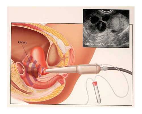 甘肃试管代孕总费用 2026甘肃试管婴儿医院排名最新排行榜，附甘肃试管助孕费
