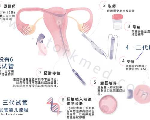 广州借卵代怀生子医院排名前十有哪些？附详细介绍？